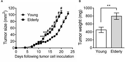 Macrophage Depletion in Elderly Mice Improves Response to Tumor Immunotherapy, Increases Anti-tumor T Cell Activity and Reduces Treatment-Induced Cachexia